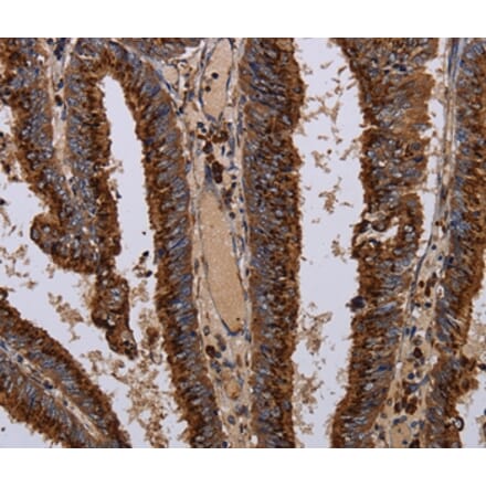 Immunohistochemistry - PPP1R1B Antibody from Signalway Antibody (36398) - Antibodies.com
