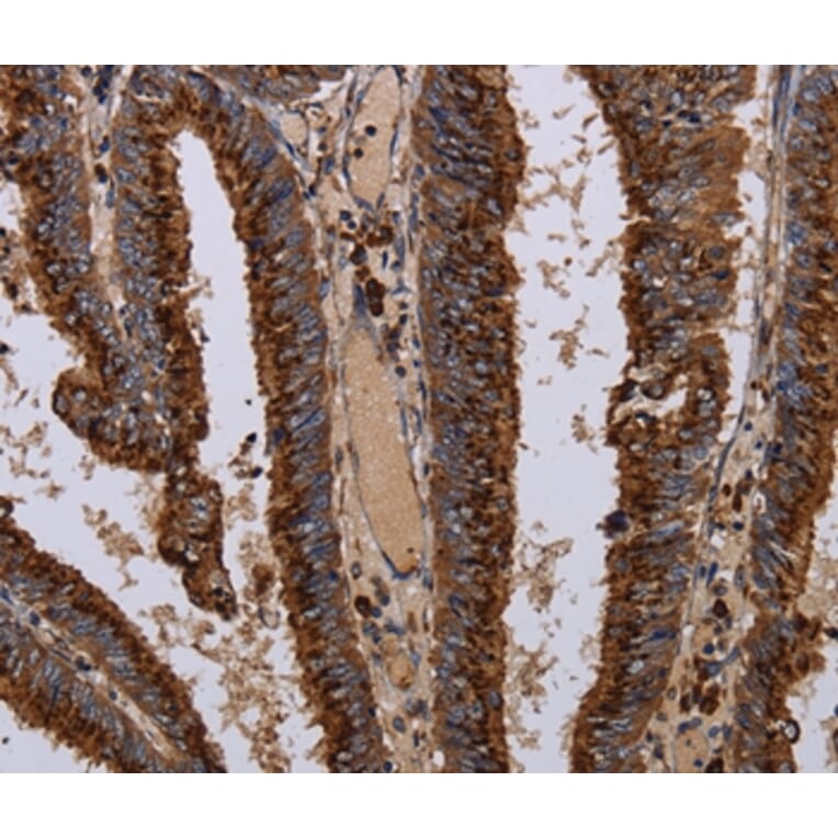 Immunohistochemistry - PPP1R1B Antibody from Signalway Antibody (36398) - Antibodies.com