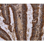 Immunohistochemistry - PPP1R1B Antibody from Signalway Antibody (36398) - Antibodies.com