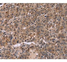 Immunohistochemistry - FAM107A Antibody from Signalway Antibody (36461) - Antibodies.com