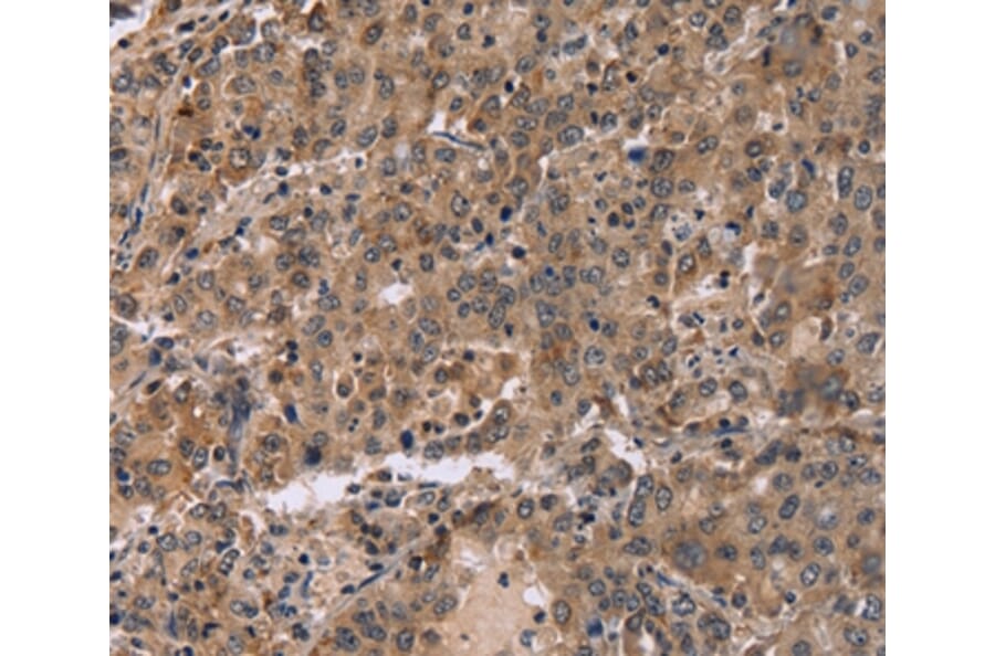 Immunohistochemistry - FAM107A Antibody from Signalway Antibody (36461) - Antibodies.com