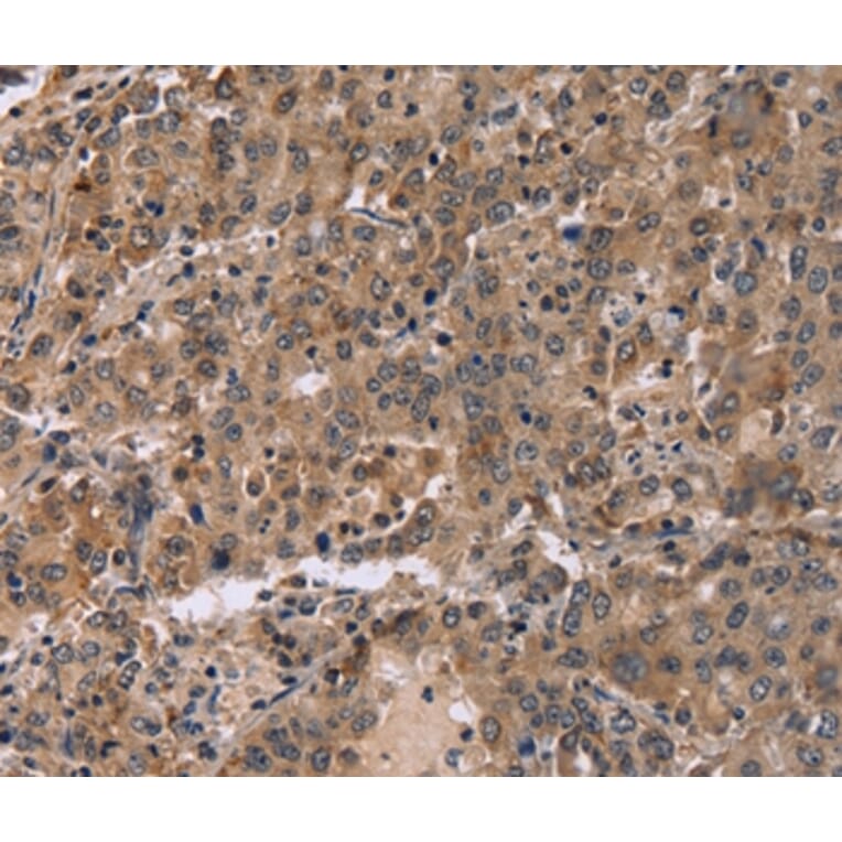 Immunohistochemistry - FAM107A Antibody from Signalway Antibody (36461) - Antibodies.com