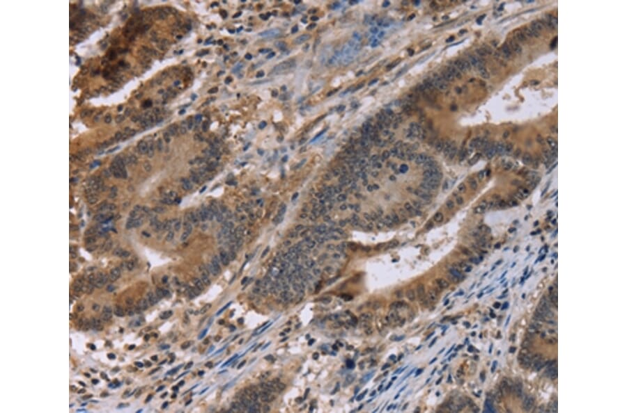 Immunohistochemistry - FAM107A Antibody from Signalway Antibody (36461) - Antibodies.com