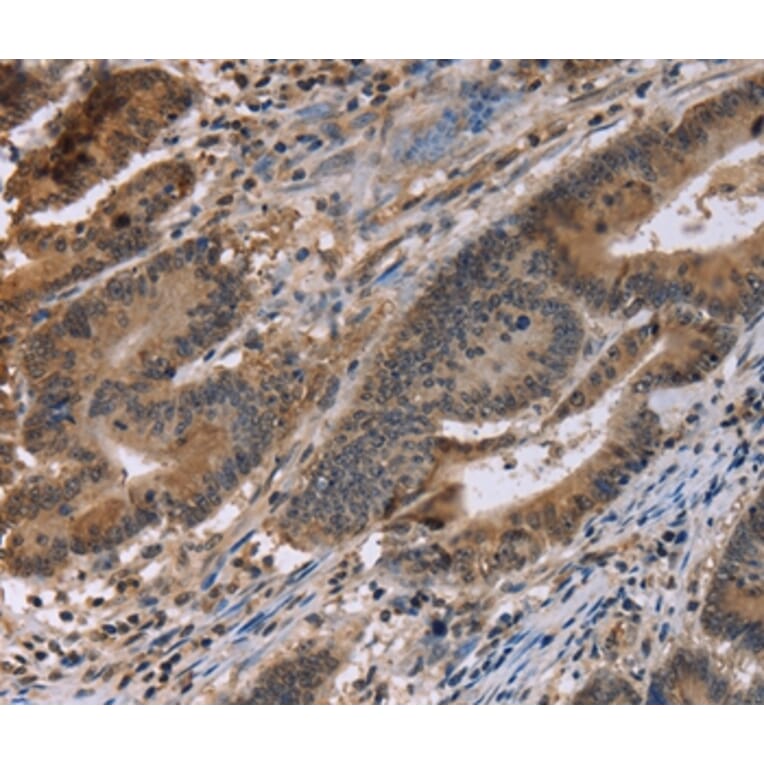 Immunohistochemistry - FAM107A Antibody from Signalway Antibody (36461) - Antibodies.com