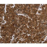 Immunohistochemistry - FASTKD1 Antibody from Signalway Antibody (36468) - Antibodies.com