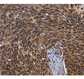 Immunohistochemistry - FASTKD5 Antibody from Signalway Antibody (36469) - Antibodies.com