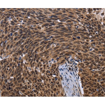 Immunohistochemistry - FASTKD5 Antibody from Signalway Antibody (36469) - Antibodies.com