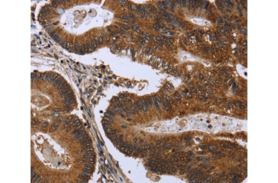 Immunohistochemistry - FGFR1OP Antibody from Signalway Antibody (36479) - Antibodies.com