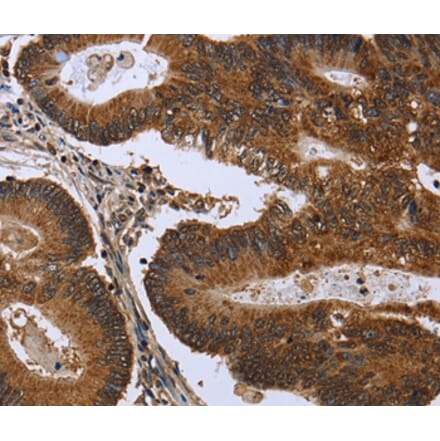 Immunohistochemistry - FGFR1OP Antibody from Signalway Antibody (36479) - Antibodies.com