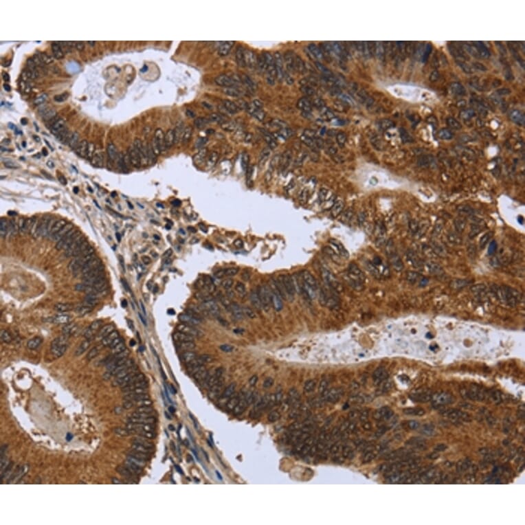 Immunohistochemistry - FGFR1OP Antibody from Signalway Antibody (36479) - Antibodies.com