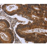 Immunohistochemistry - FGFR1OP Antibody from Signalway Antibody (36479) - Antibodies.com