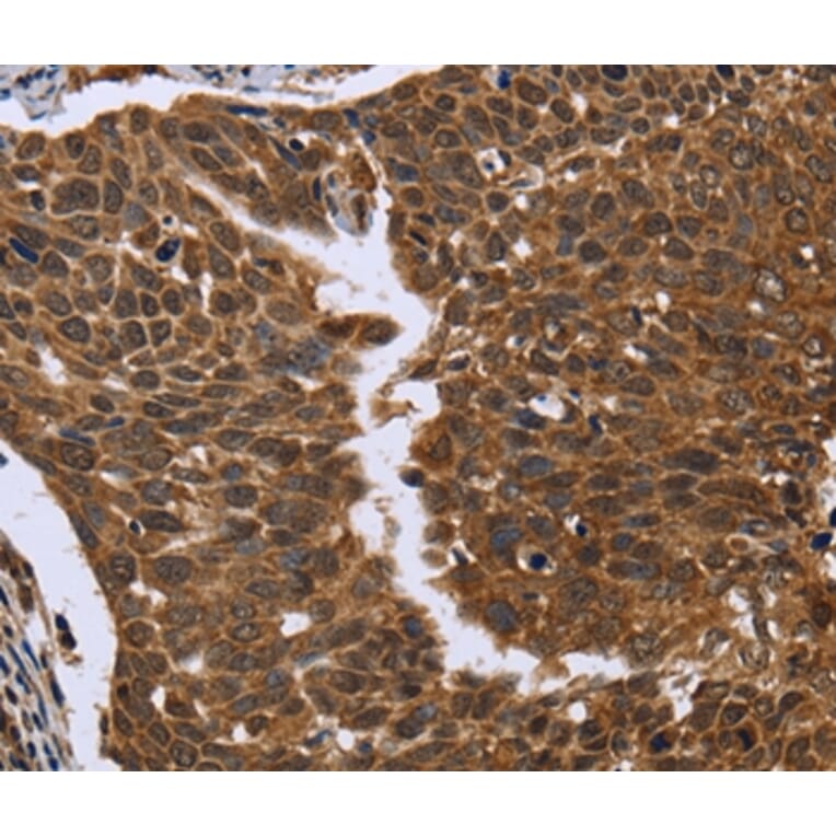 Immunohistochemistry - FGFR1OP Antibody from Signalway Antibody (36479) - Antibodies.com