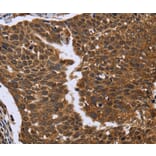 Immunohistochemistry - FGFR1OP Antibody from Signalway Antibody (36479) - Antibodies.com