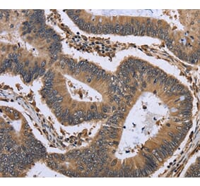 Immunohistochemistry - GADD45B Antibody from Signalway Antibody (36492) - Antibodies.com