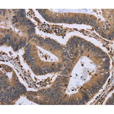 Immunohistochemistry - GADD45B Antibody from Signalway Antibody (36492) - Antibodies.com