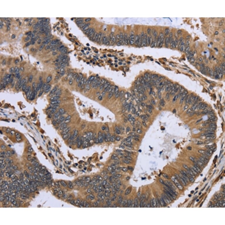 Immunohistochemistry - GADD45B Antibody from Signalway Antibody (36492) - Antibodies.com