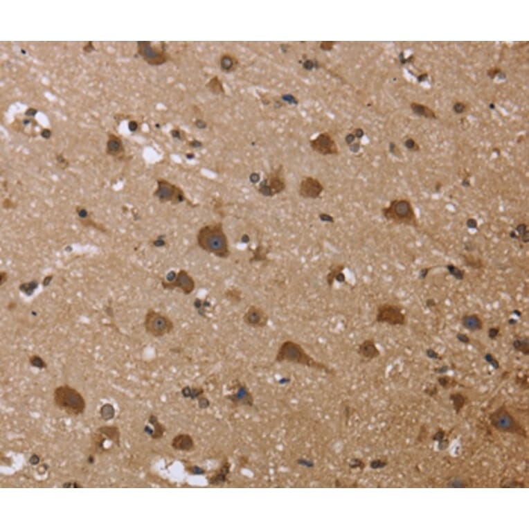 Immunohistochemistry - GADD45B Antibody from Signalway Antibody (36492) - Antibodies.com