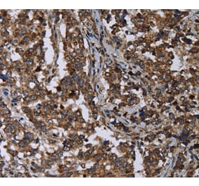 Immunohistochemistry - DNAJC15 Antibody from Signalway Antibody (36503) - Antibodies.com