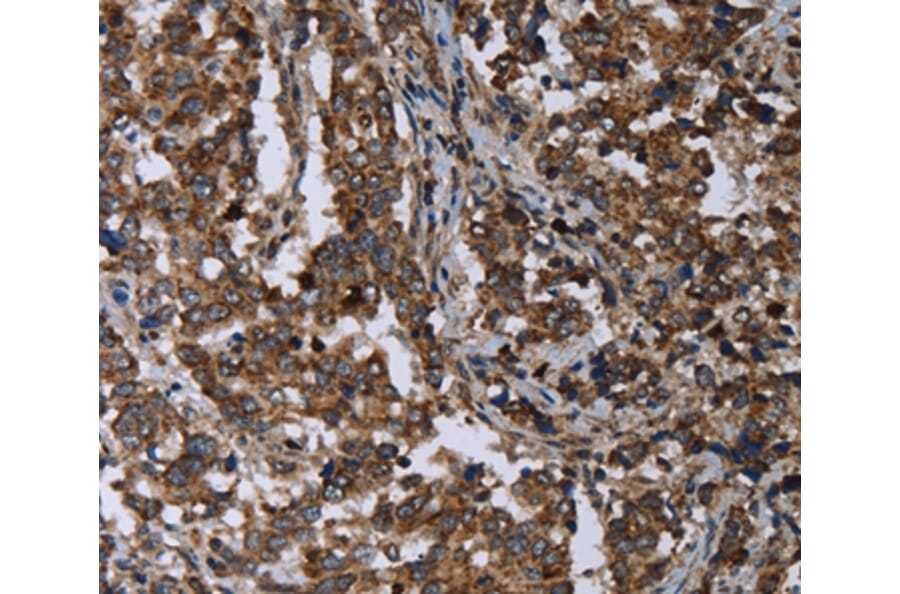 Immunohistochemistry - DNAJC15 Antibody from Signalway Antibody (36503) - Antibodies.com