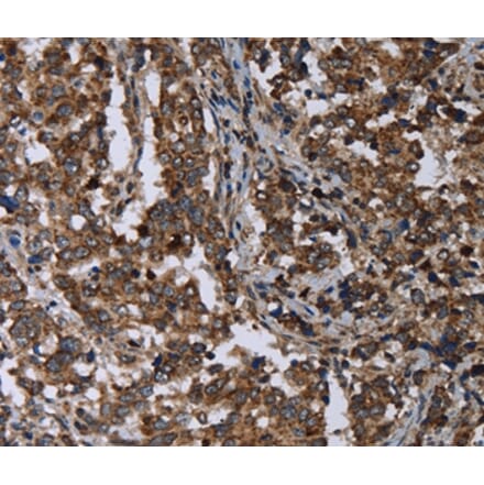 Immunohistochemistry - DNAJC15 Antibody from Signalway Antibody (36503) - Antibodies.com