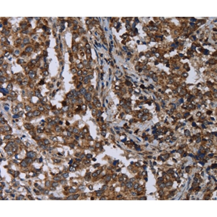 Immunohistochemistry - DNAJC15 Antibody from Signalway Antibody (36503) - Antibodies.com