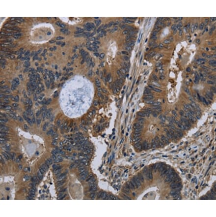 Immunohistochemistry - TSC22D3 Antibody from Signalway Antibody (36504) - Antibodies.com