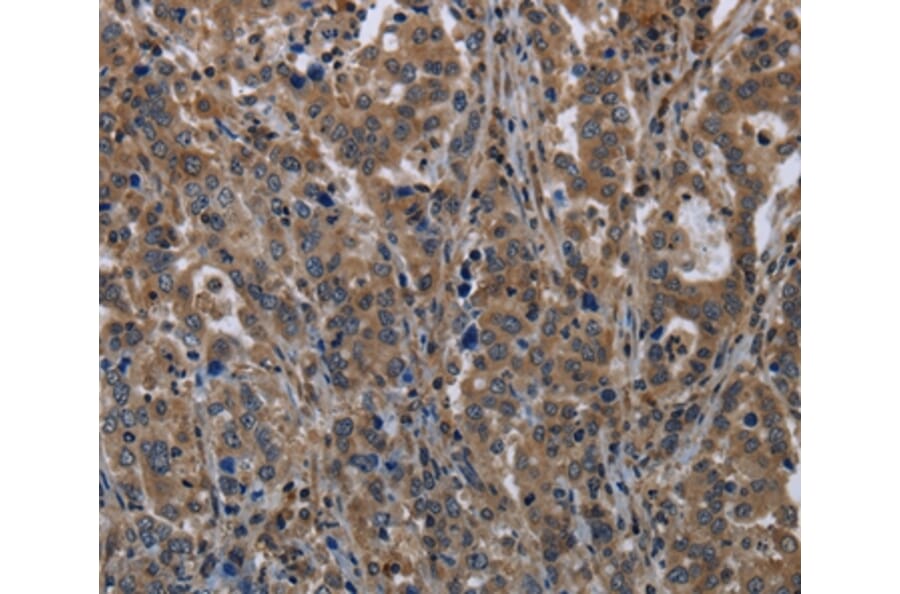 Immunohistochemistry - TSC22D3 Antibody from Signalway Antibody (36504) - Antibodies.com