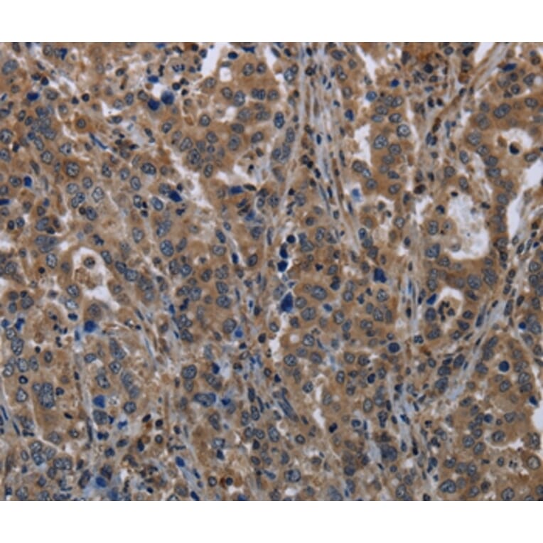 Immunohistochemistry - TSC22D3 Antibody from Signalway Antibody (36504) - Antibodies.com