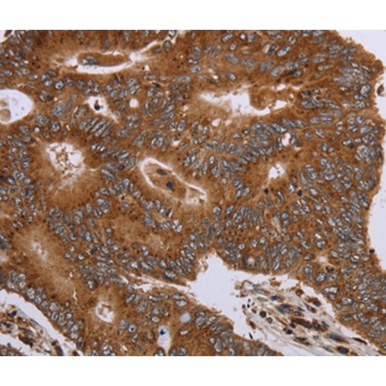 Immunohistochemistry - HSD17B4 Antibody from Signalway Antibody (36531) - Antibodies.com