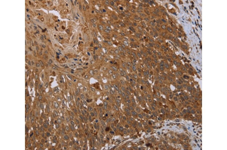 Immunohistochemistry - HSD17B4 Antibody from Signalway Antibody (36531) - Antibodies.com