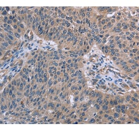 Immunohistochemistry - RNF144B Antibody from Signalway Antibody (36541) - Antibodies.com