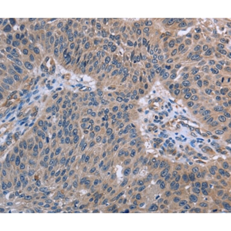 Immunohistochemistry - RNF144B Antibody from Signalway Antibody (36541) - Antibodies.com