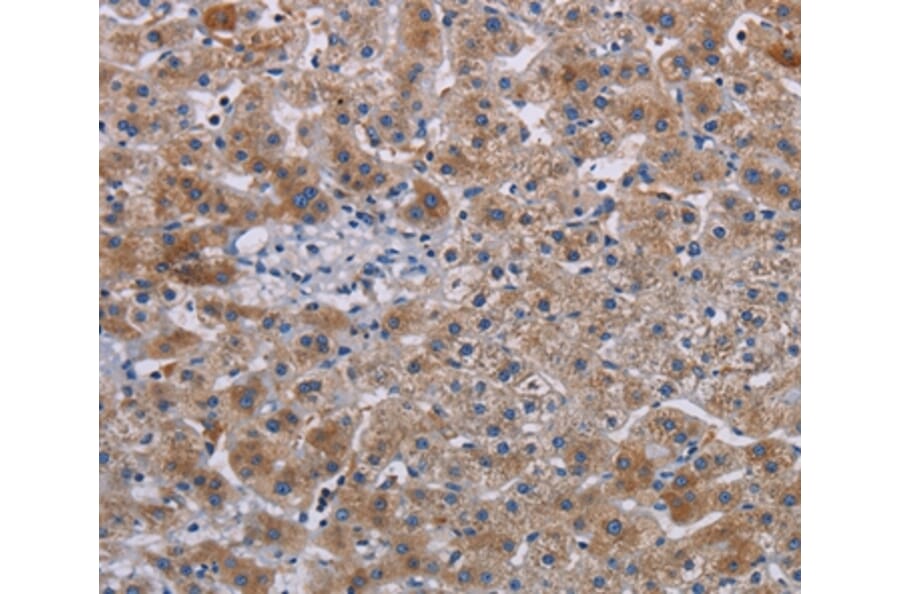 Immunohistochemistry - JAKMIP2 Antibody from Signalway Antibody (36561) - Antibodies.com