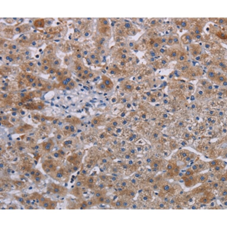 Immunohistochemistry - JAKMIP2 Antibody from Signalway Antibody (36561) - Antibodies.com