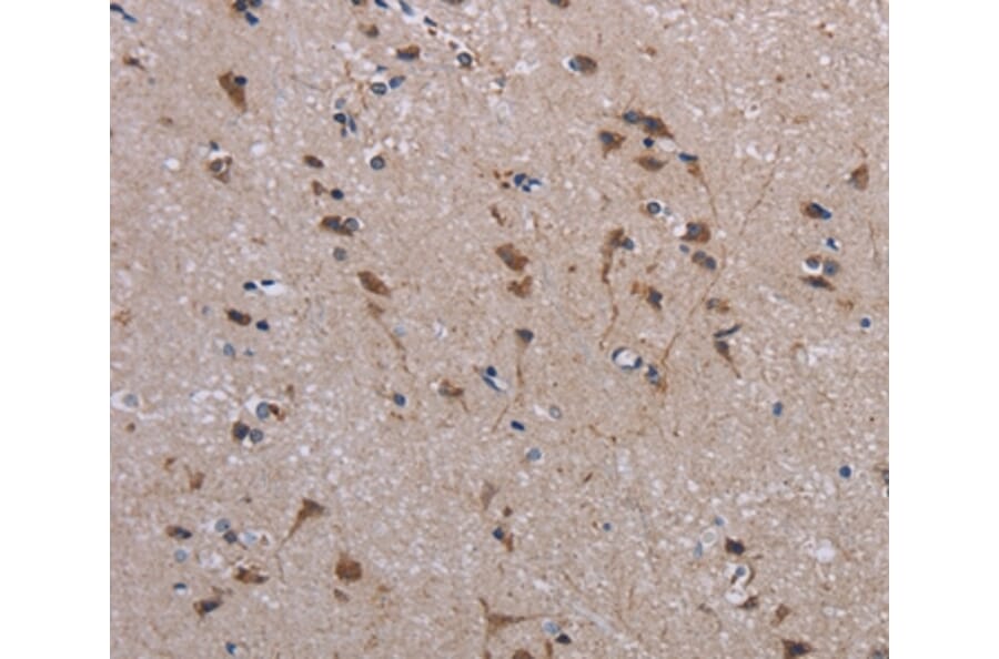 Immunohistochemistry - JAKMIP2 Antibody from Signalway Antibody (36561) - Antibodies.com
