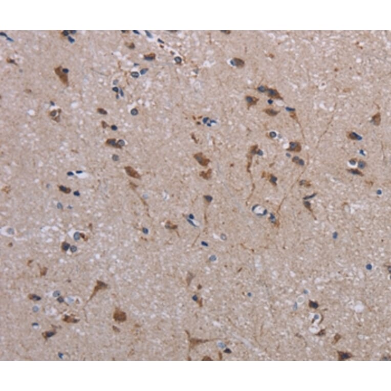 Immunohistochemistry - JAKMIP2 Antibody from Signalway Antibody (36561) - Antibodies.com