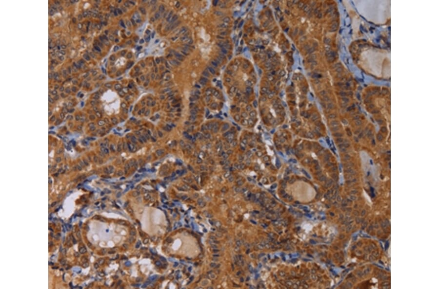 Immunohistochemistry - MAGEB10 Antibody from Signalway Antibody (36596) - Antibodies.com