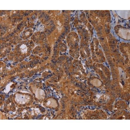 Immunohistochemistry - MAGEB10 Antibody from Signalway Antibody (36596) - Antibodies.com