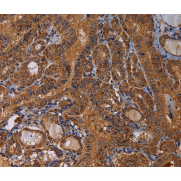 Immunohistochemistry - MAGEB10 Antibody from Signalway Antibody (36596) - Antibodies.com