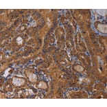 Immunohistochemistry - MAGEB10 Antibody from Signalway Antibody (36596) - Antibodies.com