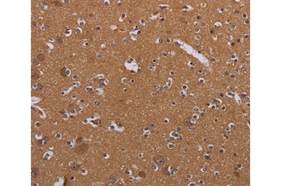 Immunohistochemistry - MAGEB10 Antibody from Signalway Antibody (36596) - Antibodies.com