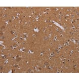 Immunohistochemistry - MAGEB10 Antibody from Signalway Antibody (36596) - Antibodies.com