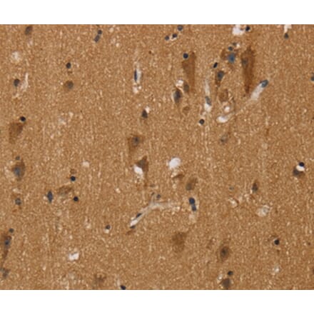 Immunohistochemistry - NGFRAP1 Antibody from Signalway Antibody (36629) - Antibodies.com