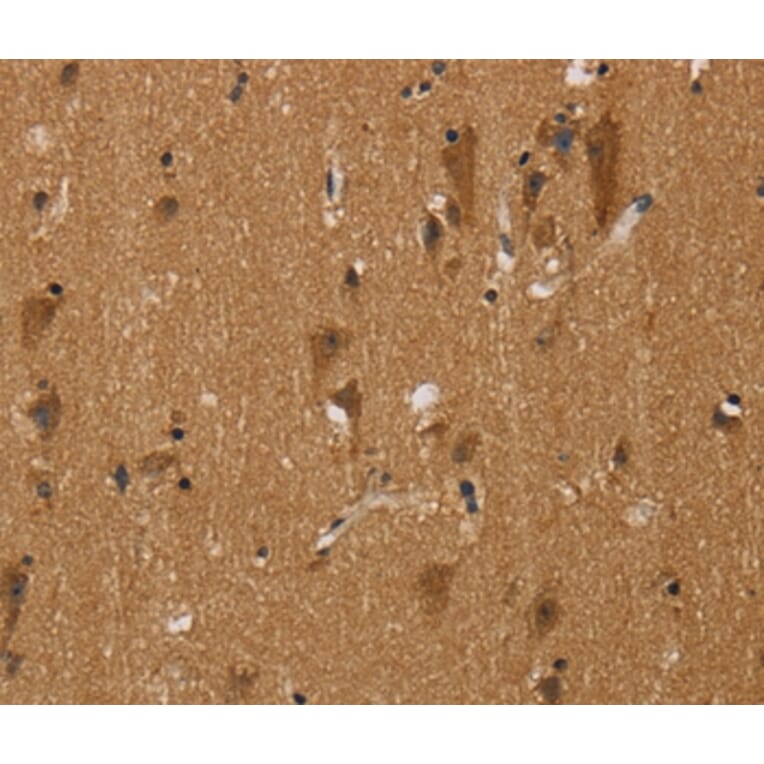 Immunohistochemistry - NGFRAP1 Antibody from Signalway Antibody (36629) - Antibodies.com