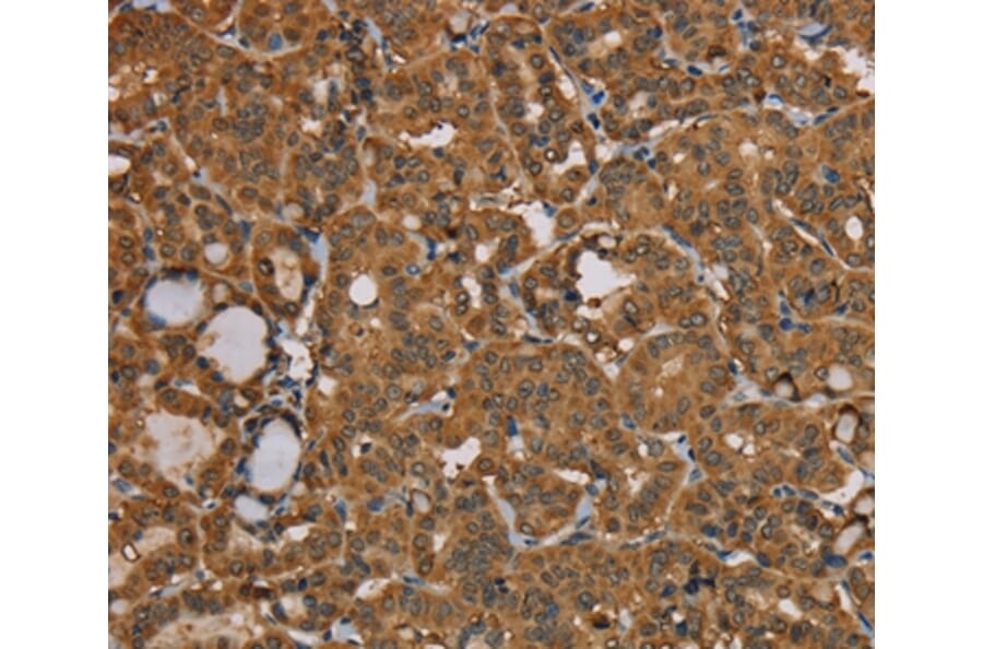 Immunohistochemistry - NGFRAP1 Antibody from Signalway Antibody (36629) - Antibodies.com