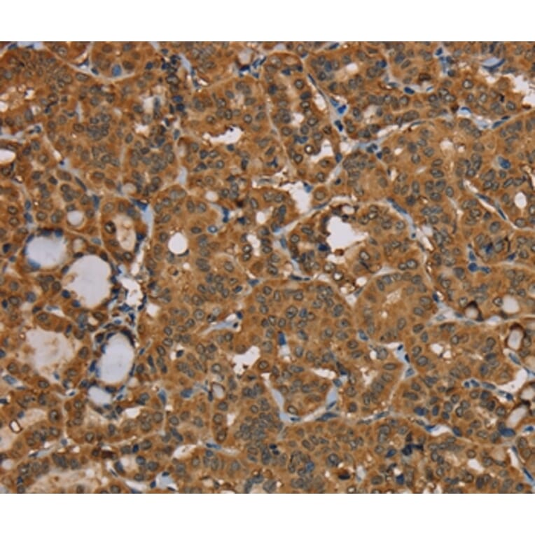 Immunohistochemistry - NGFRAP1 Antibody from Signalway Antibody (36629) - Antibodies.com