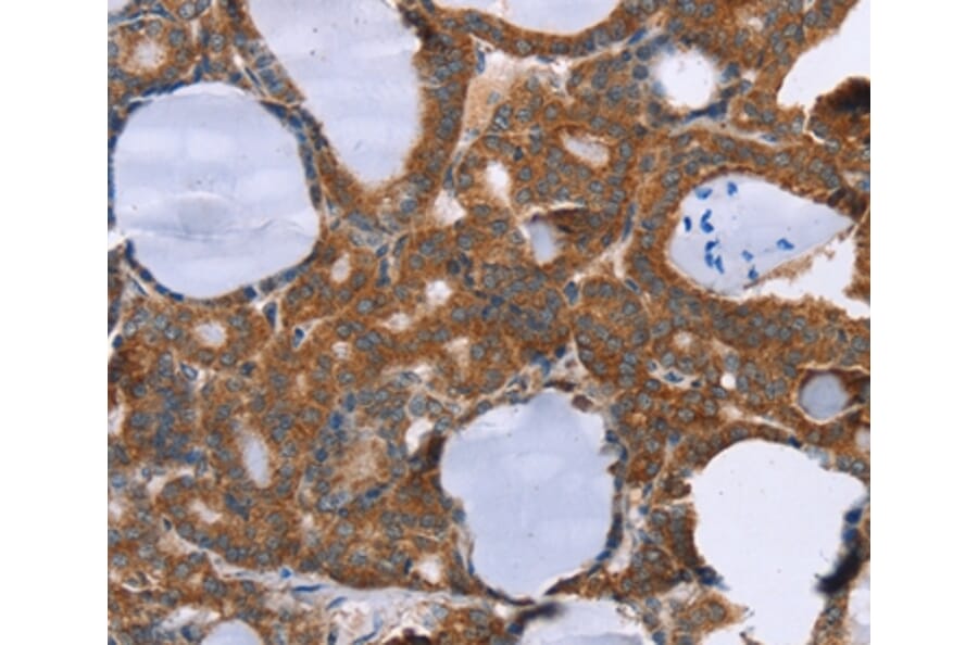 Immunohistochemistry - PITPNM1 Antibody from Signalway Antibody (36651) - Antibodies.com