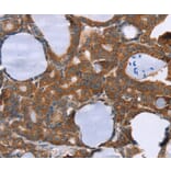 Immunohistochemistry - PITPNM1 Antibody from Signalway Antibody (36651) - Antibodies.com