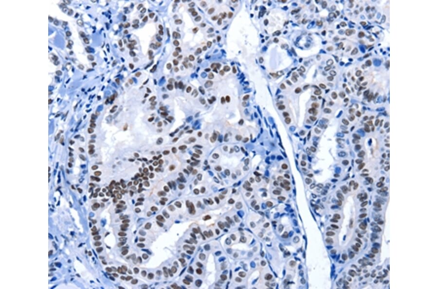 Immunohistochemistry - POU2AF1 Antibody from Signalway Antibody (36775) - Antibodies.com