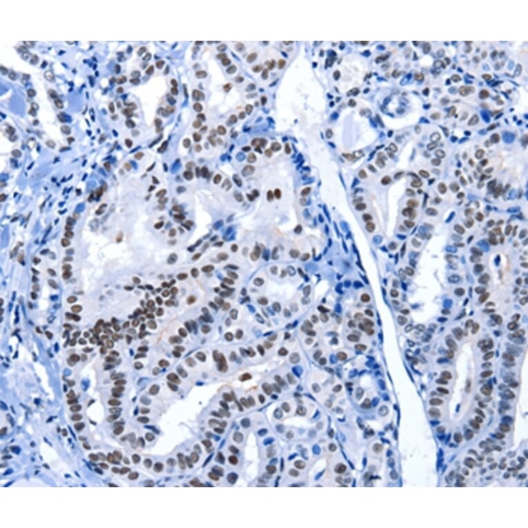 Immunohistochemistry - POU2AF1 Antibody from Signalway Antibody (36775) - Antibodies.com